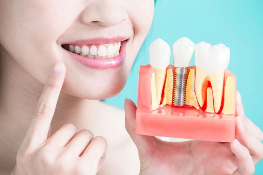 Carlsbad Dental Implants