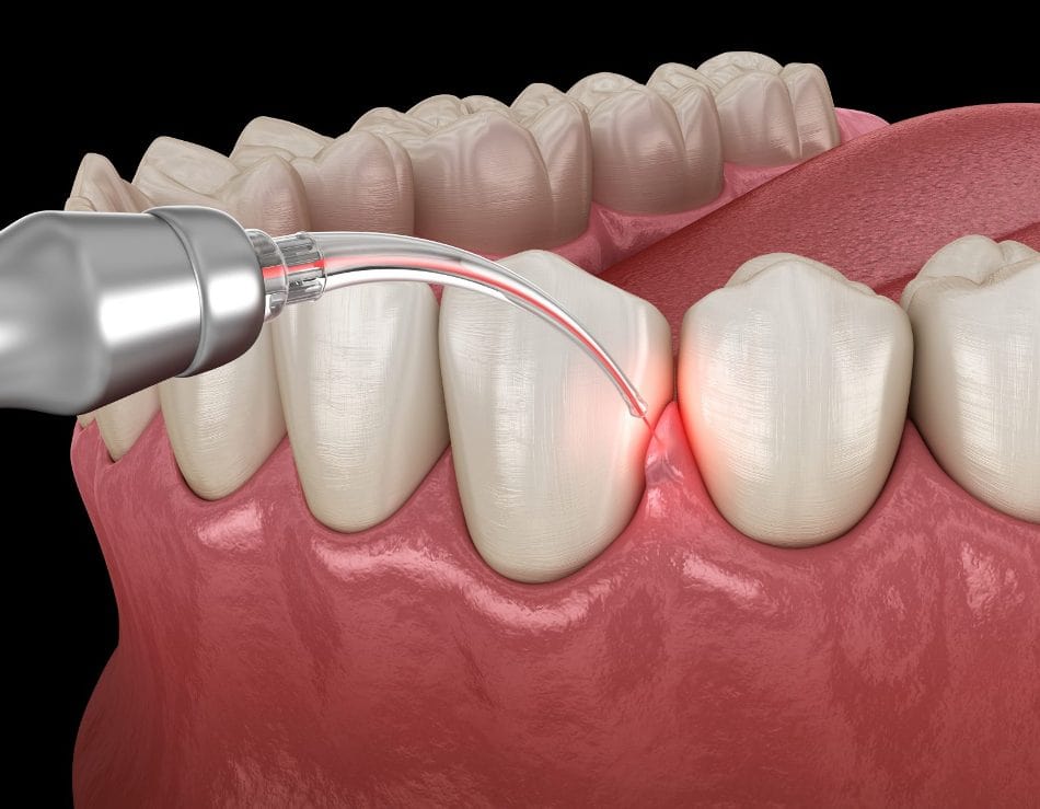 Carlsbad Periodontist