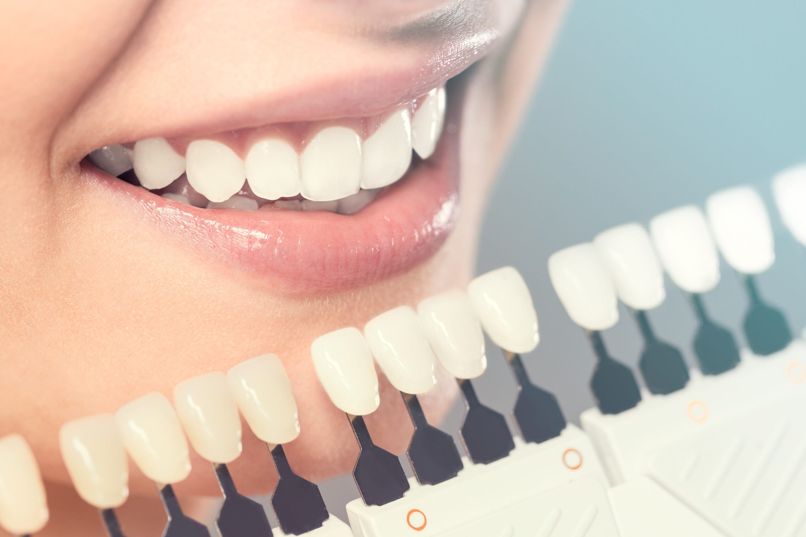 Tooth Filling in Carlsbad: Repairing and Protecting Your Smile - Dentist in  Oceanside CA, Grace Dental, Oceanside Dentist