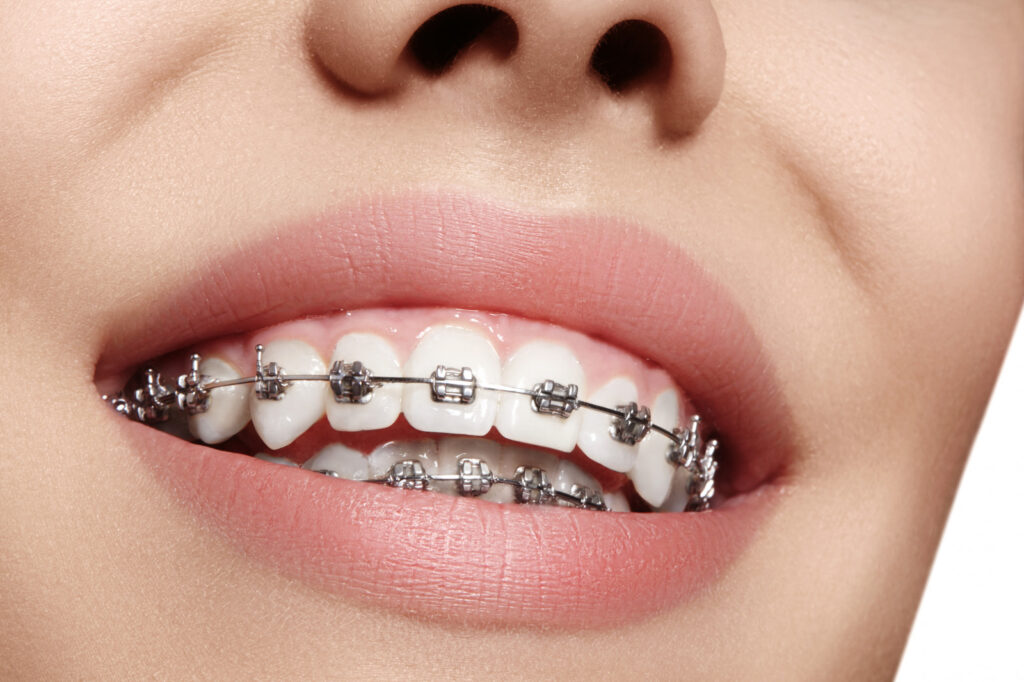 Orthodontist Near Me Carlsbad