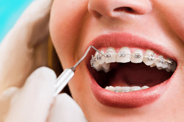 Orthodontist Near Me Carlsbad