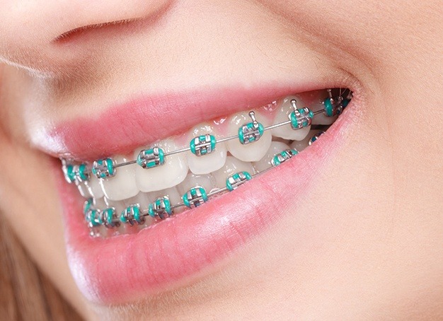 Orthodontist Near Me Oceanside