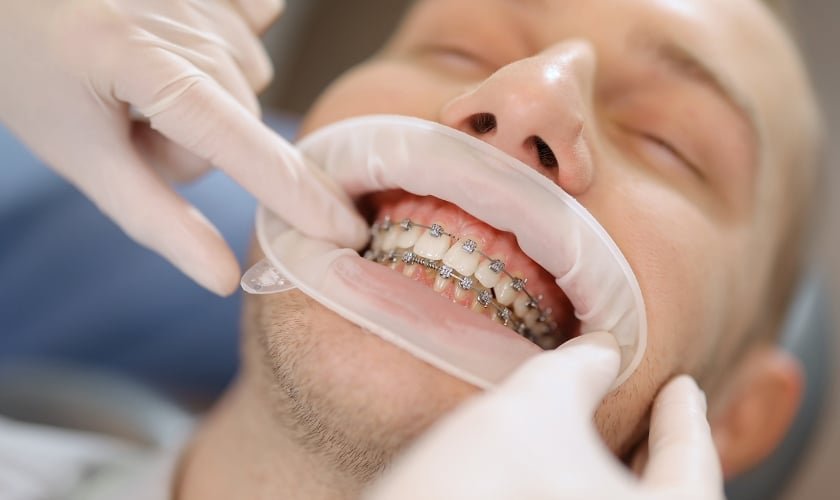 Orthodontist Near Me Vista