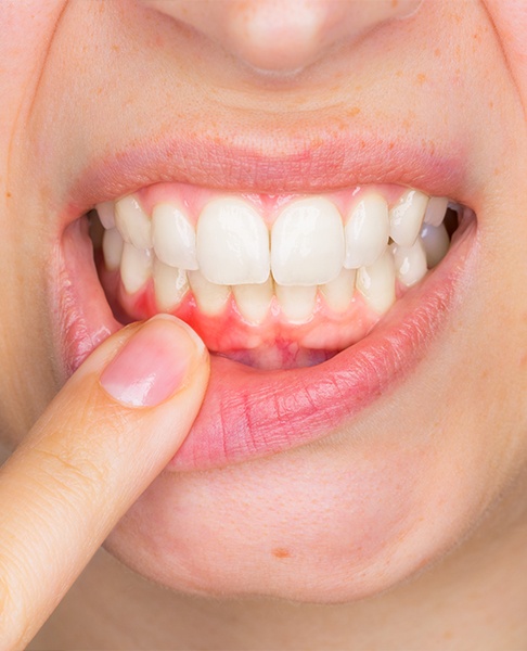 Oceanside Periodontist