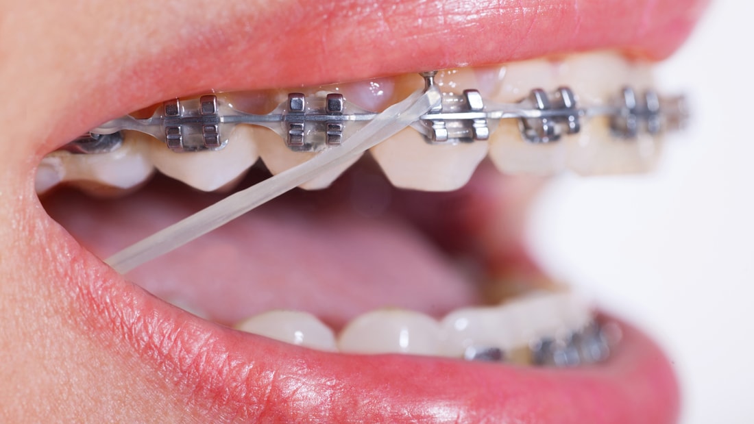 Carlsbad Orthodontist Near Me