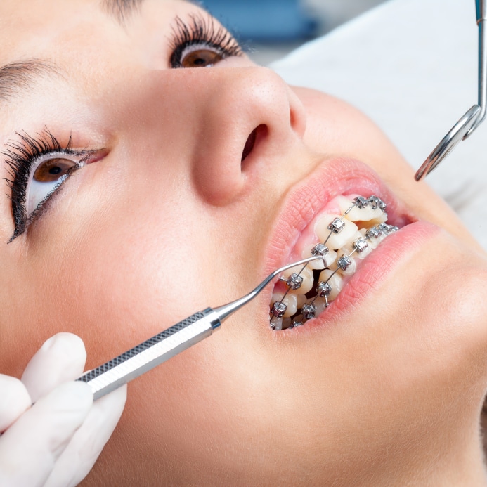Oceanside Orthodontist Near Me