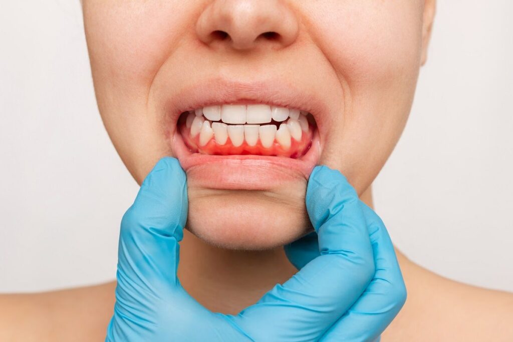 Vista Periodontist